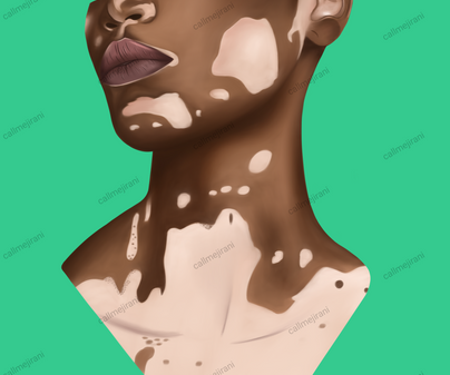 Kennedy  Kyalo, 22, Marks on your skin, print